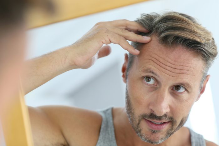 нормы выпадения волос у мужчин